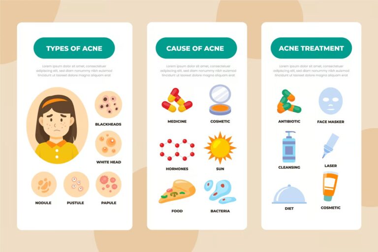 Hand Drawn Acne Oily Skin Problems Infographic